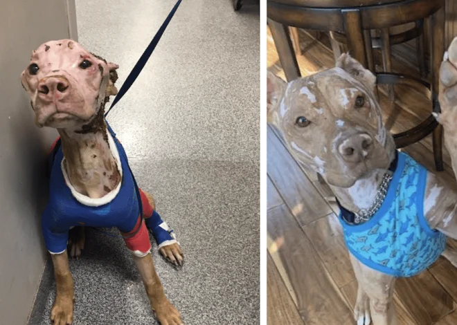 Severely Burned Pitbull Defies the Odds and Embraces a Joyful Life